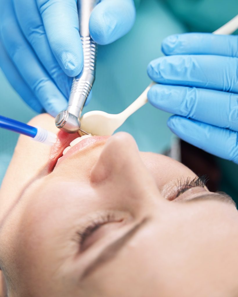 Dentist hands performing dental procedure with dental drill